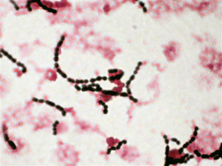 image streptococcus agalactiae